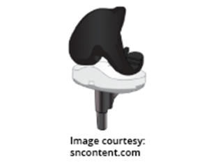 JOURNEY◊ II Active Knee Solutions