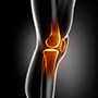 Muscle Sparing Total Knee Replacement