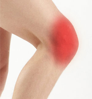 Knee Pain