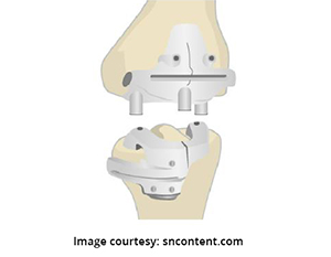 VISIONAIRE◊ Patient Matched Technology